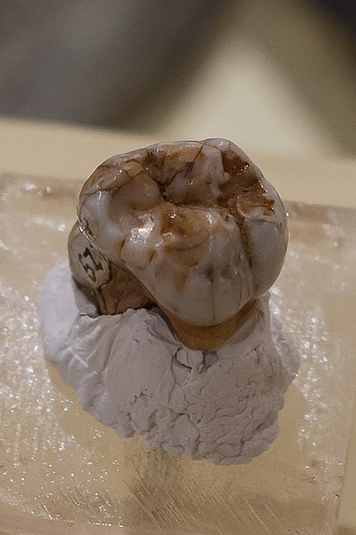 molare denisovan