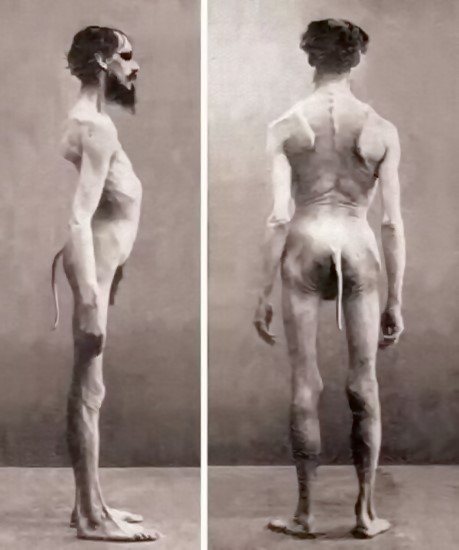 coda nell'uomo