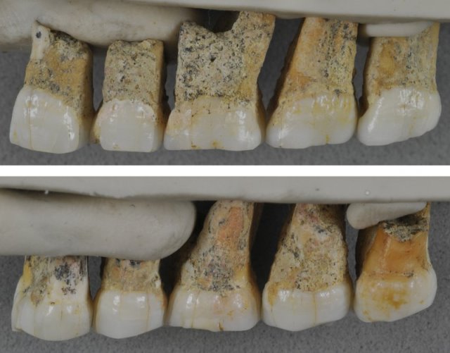 denti di H. luzonensis